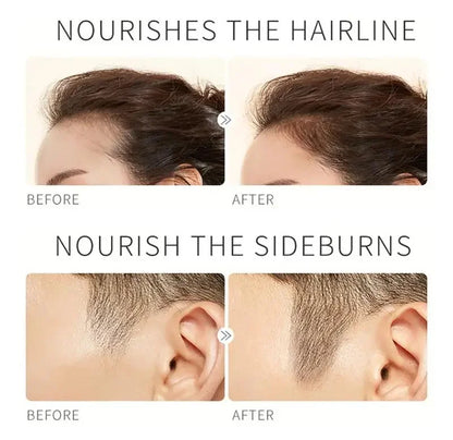 Fast Eyebrow Growth Serum Eyelash Hair Growth Anti Hairs Loss Product Prevent Baldness Fuller Thicker Lengthening Eyebrow Makeup - AMULET RING STORE