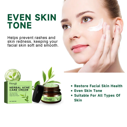 Acne Face Cream Pimple Treatment Oil Control Repair Redness Remove Blackhead Smooth Hydrating Moisturizing Pore Shrinking Serum - AMULET RING STORE