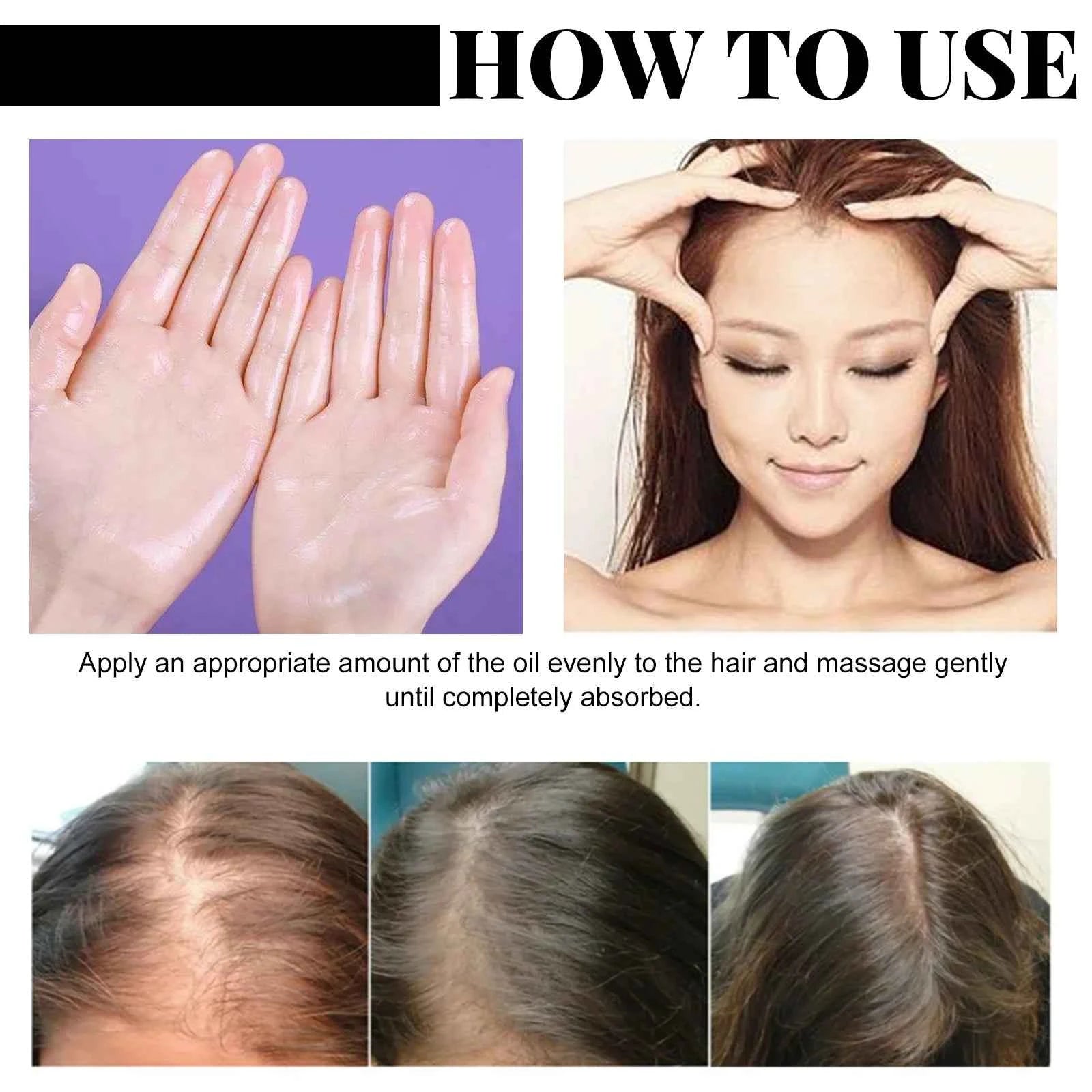 Fast Hair Growth Set Batana Oil Traction Alopecia Hair Mask Anti Break Loss Hair Growth Oil Baldness Treatment Hair Health Care