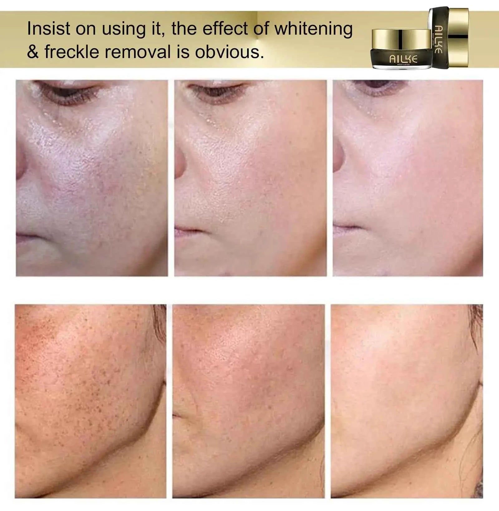 AILKE Whitening Face Cream, Antioxidant, Reduce Dark Spots, Inhibit Melanin, Anti-aging, With Collagen, Niacinamide, Glutathione