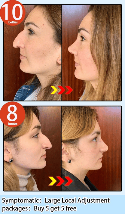 Nose Massage Essential Oil Up Heighten Rhinoplasty Firming For Moisturizing Nose Serum Reshape Natural Face Beauty Care Products - AMULET RING STORE