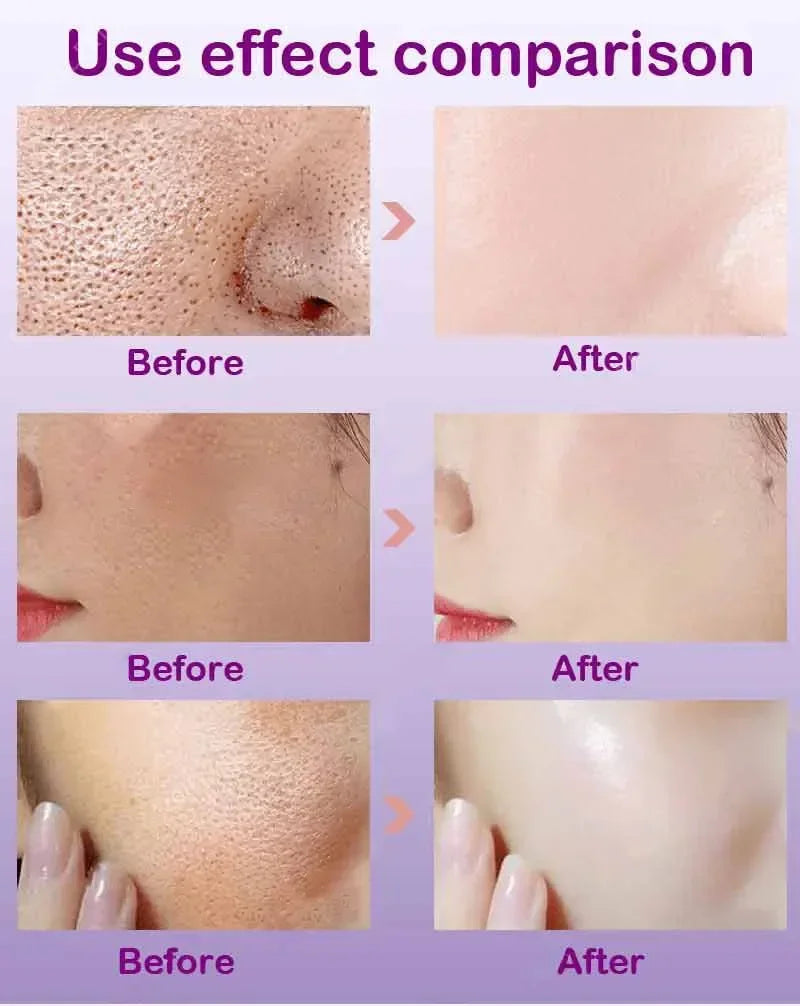 Skin Texture | Pore Refining Resurfacing, Brightening Facial Serum with Retinol and Niacinamide Non-Comedogenic - AMULET RING STORE