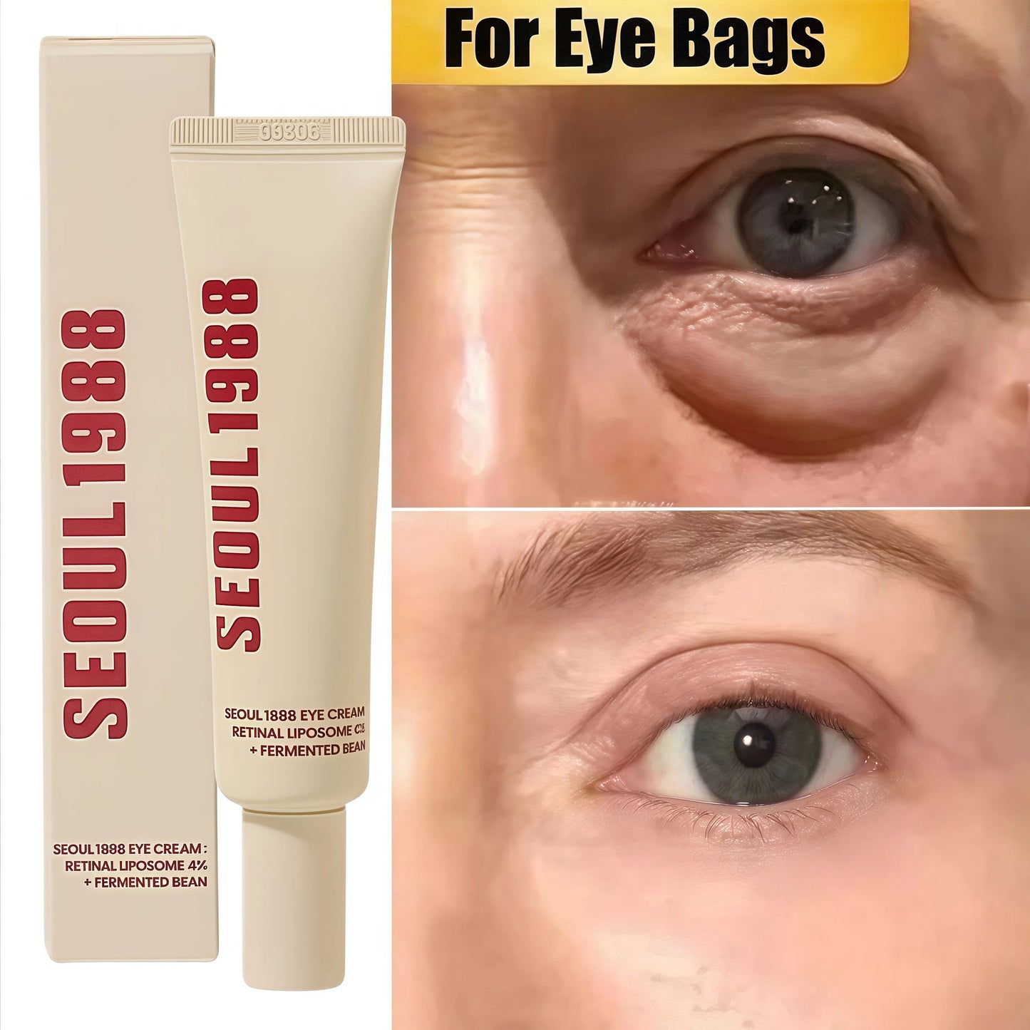 SEOUL 1988 Eye Cream Niacinamide 2% Retinal Acid Ginseng Serum Lighten Fine Lines Firming Pores Brightening Face Korean Skincare - AMULET RING STORE