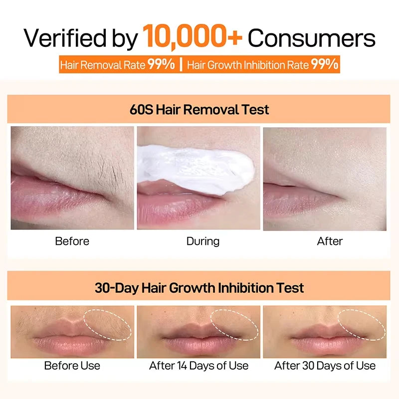3 Minutes Fast Hair Removal Cream Painless Hair Growth Inhibitor Lip Face Arm Armpit Leg Permanent Depilatory for Men Women Care - AMULET RING STORE