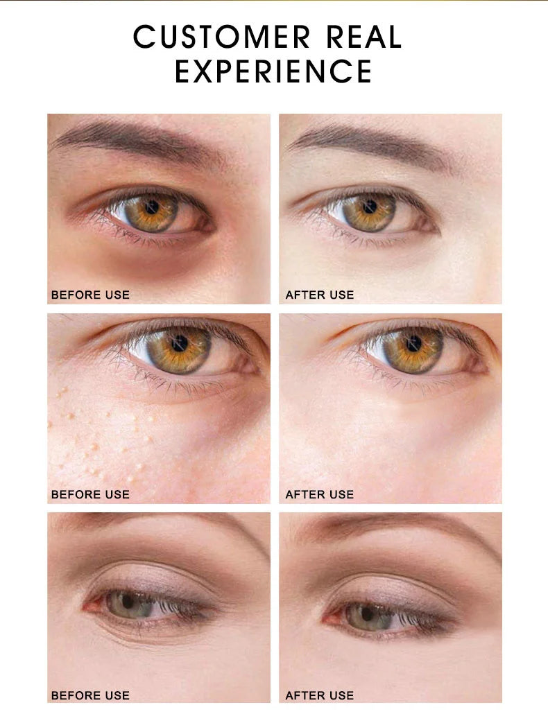 ARTISCARE 24K Gold Serum SET for Facial Care Eye Cream Moisturizing Face Essence Skin Care Products