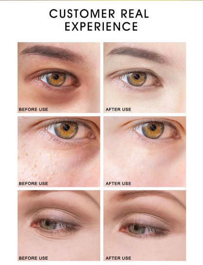 ARTISCARE 24K Gold Serum SET for Facial Care Eye Cream Moisturizing Face Essence Skin Care Products