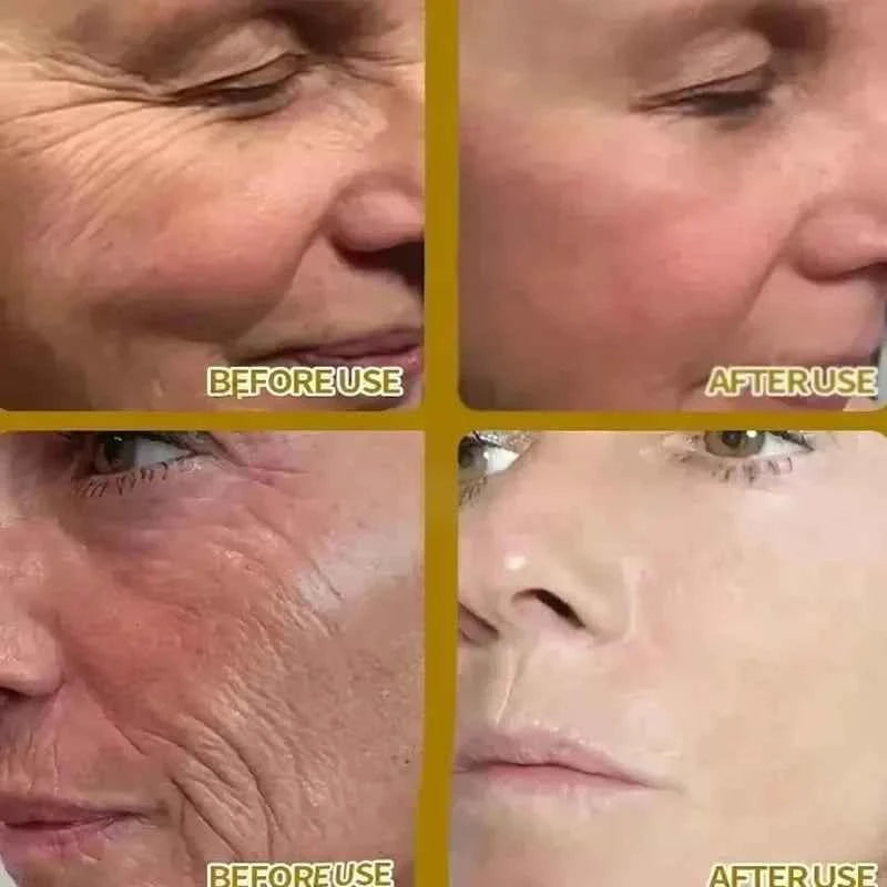 SEOUL 1988 Vitamin C Wrinkle Care 4% Retinol Ginseng Face Serum Firm Fine Lines Eye Cream Hydrating Moisturizing Brightening Set