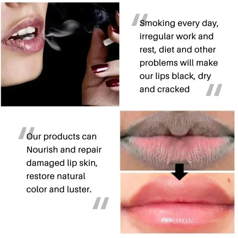Remove Dark Lip Balm Fast Lightening Pink Lip Exfoliating Fade Lip Line Dead Skin Moisturizer Korean Care Products Beauty Health - AMULET RING STORE
