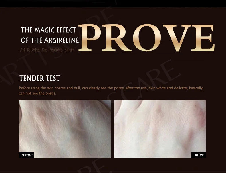 ARTISCARE Aging & Beauty Eyes Serum SET Anti Dark Circles Wrinkles Removal Coenzyme Q10 Six Peptides cream 3Pcs