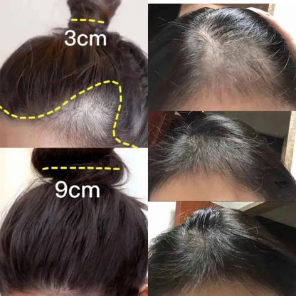 Fast Ginger Hair Growth Cream Anti Hair Loss Baldness Repair Damaged Scalp Treatment Nourish Hair Root Care Products Women Men
