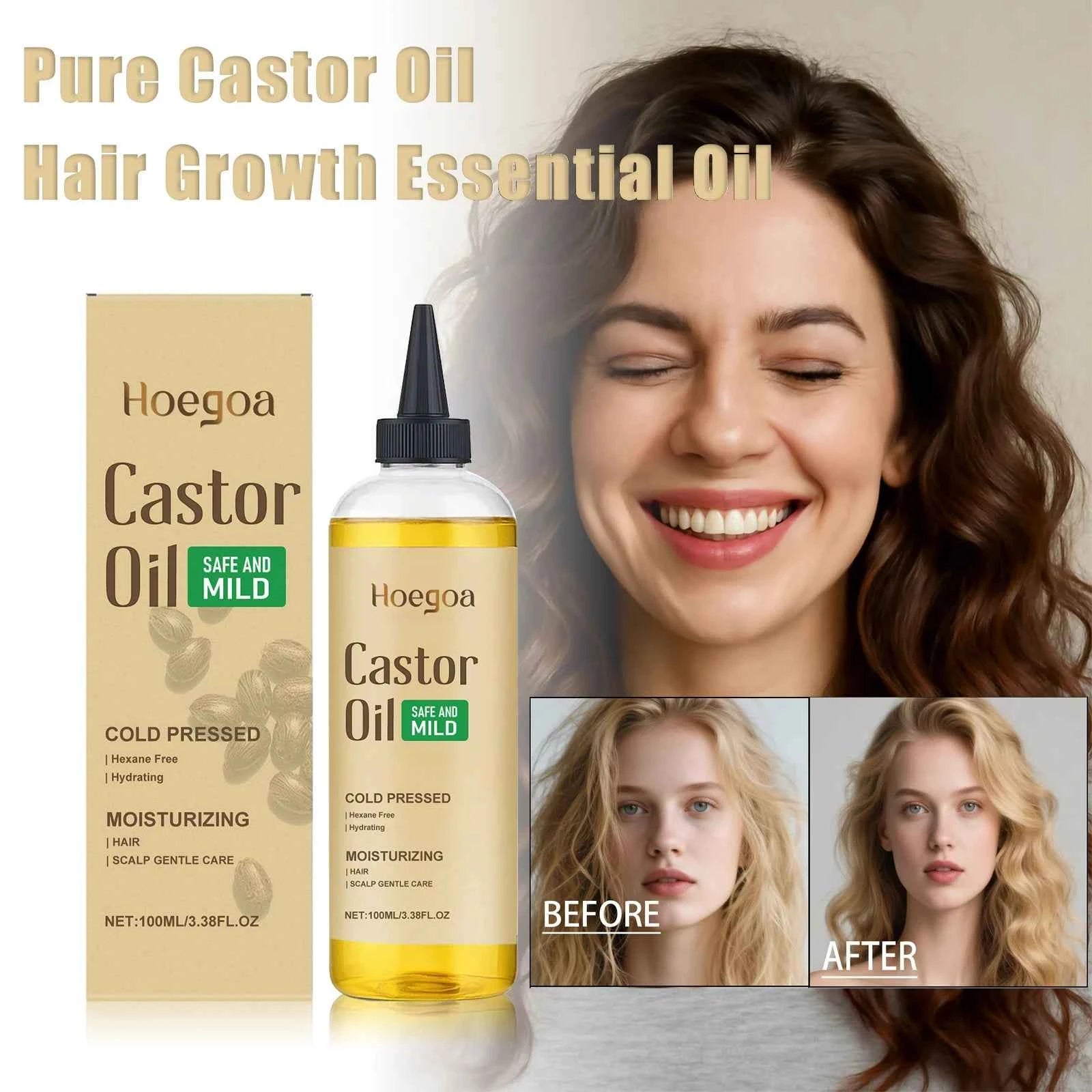 Hair Booster Castor Oil Hair Essence Treatment Improve Androgenetic Alopecia Scalp Treatment Serum Strengthen Hair Roots