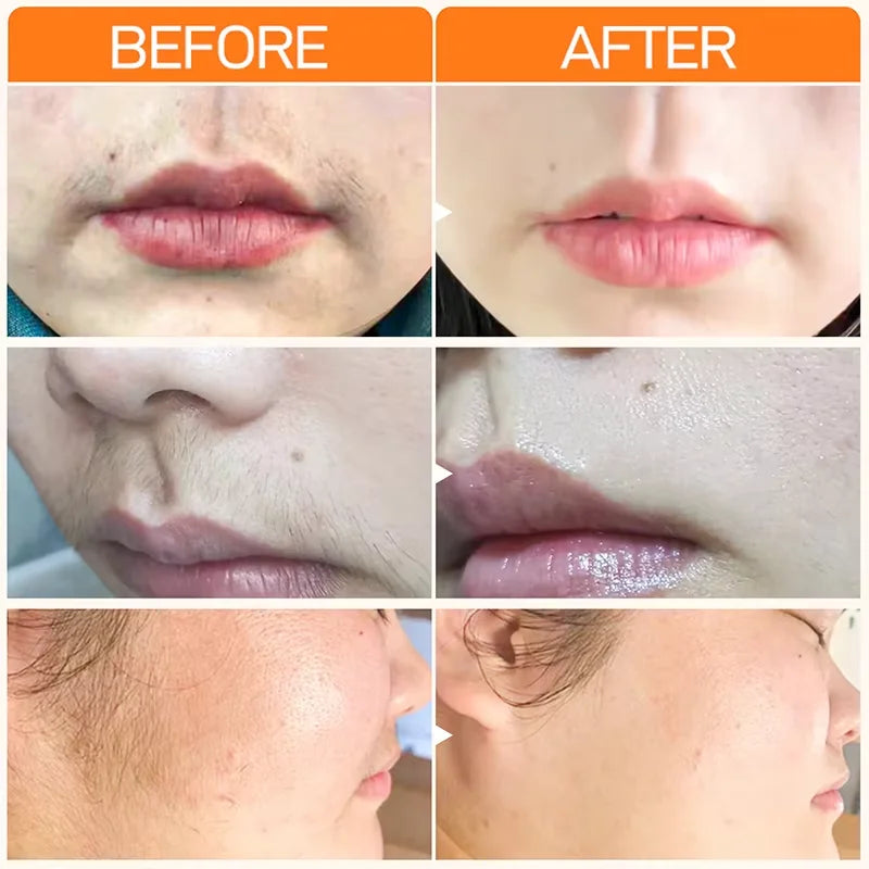 3 Minutes Fast Hair Removal Cream Painless Hair Growth Inhibitor Lip Face Arm Armpit Leg Permanent Depilatory for Men Women Care - AMULET RING STORE