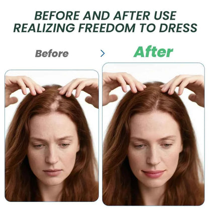 Fast Ginger Hair Growth Cream Anti Hair Loss Baldness Repair Damaged Scalp Treatment Nourish Hair Root Care Products Women Men