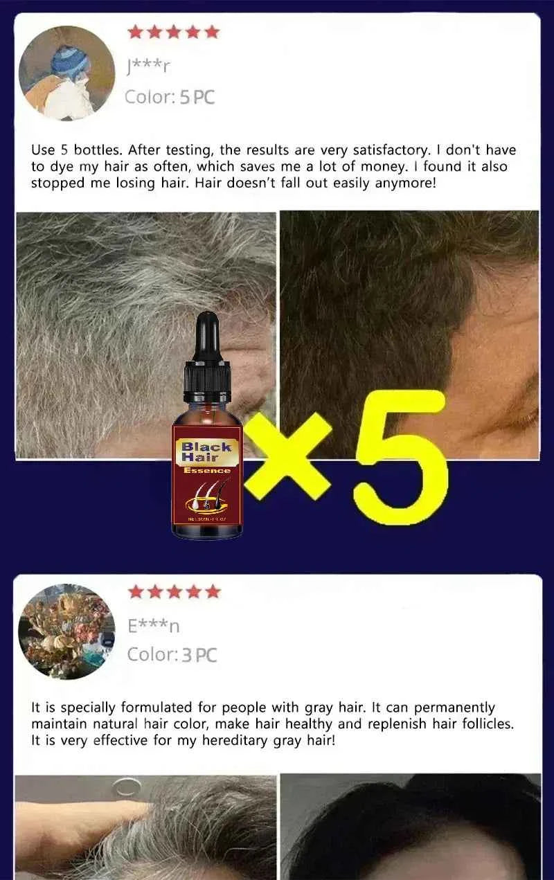 White hair killer, remove gray hair and restore natural hair color in 7 days 2025