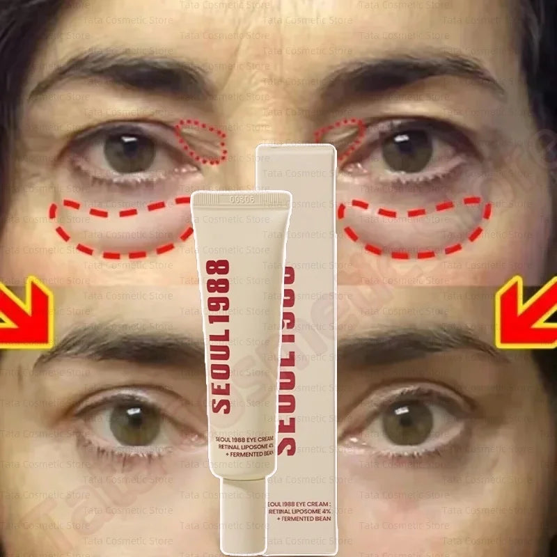 SEOUL 1988 Eye Cream Niacinamide 2% Retinal Acid Ginseng Serum Lighten Fine Lines Firming Pores Brightening Face Korean Skincare - AMULET RING STORE