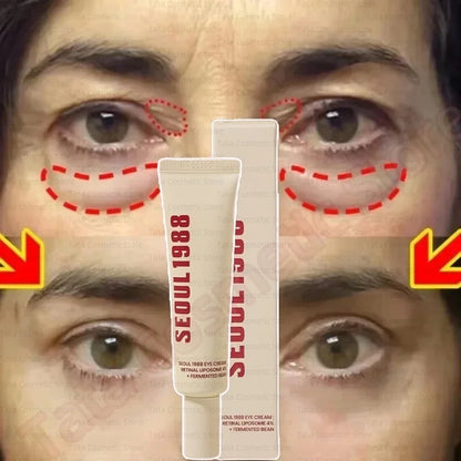 SEOUL 1988 Eye Cream Niacinamide 2% Retinal Acid Ginseng Serum Lighten Fine Lines Firming Pores Brightening Face Korean Skincare - AMULET RING STORE