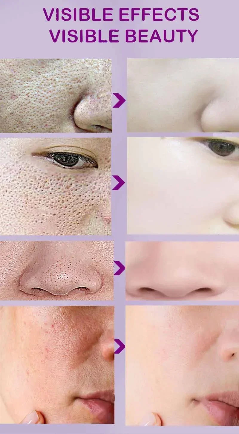 Skin Texture | Pore Refining Resurfacing, Brightening Facial Serum with Retinol and Niacinamide Non-Comedogenic - AMULET RING STORE