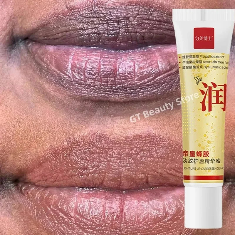 Remove Dark Lip Balm Fast Lightening Pink Lip Exfoliating Fade Lip Line Dead Skin Moisturizer Korean Care Products Beauty Health - AMULET RING STORE