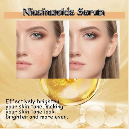 Ouhoe Niacinamide Serum Face Cleanser Brighten Skin Acne Removal Whitening Clean Pores Keratins Remove Moisturizing Skin Care