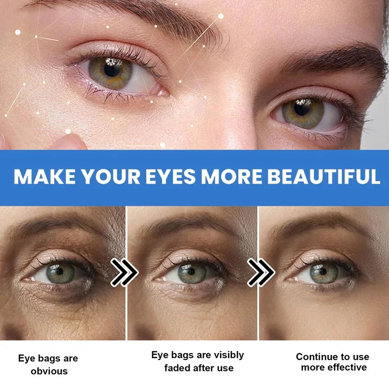 Instant Eye Bag Remove Eye Cream Anti Fat Particles Dark Circles Puffiness Fade Fine Lines Lift Brighten Korean Beauty Eye Care - AMULET RING STORE