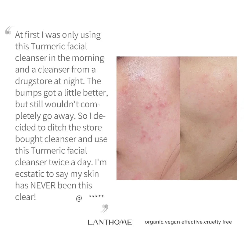 Turmeric lemon Skin Care products Acne Dark Spot Remover Whitening Brighten Facial Serum Face Cream Cleanser Serum Oil Cosmetics