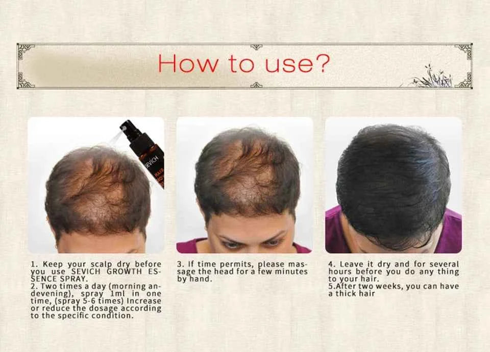 30ml Ginger Hair Growth Essence Hair Care Liquid Strengthen Hair Roots Increase Hair Luster Massag Scalp Repair Hair Essence Oil