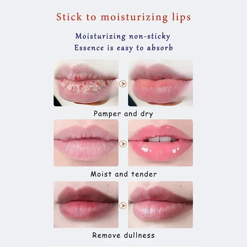Remove Dark Lip Balm Fast Lightening Pink Lip Exfoliating Fade Lip Line Dead Skin Moisturizer Korean Care Products Beauty Health - AMULET RING STORE