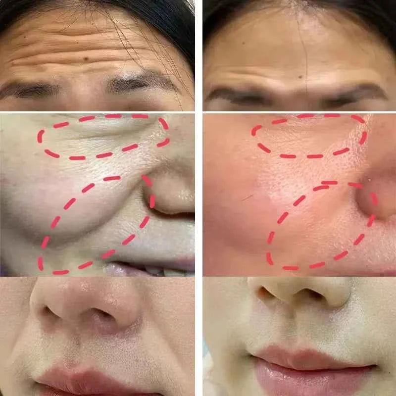 Collagen Firming Laugh Lines Patches Instant Wrinkle Remover Fade Fine Lines Facial Mask Anti-aging Brighten Repair Skin Care