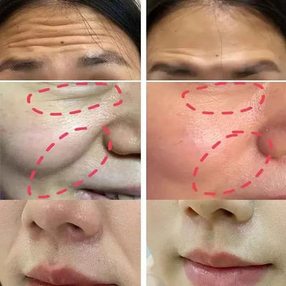 Collagen Firming Laugh Lines Patches Instant Wrinkle Remover Fade Fine Lines Facial Mask Anti-aging Brighten Repair Skin Care