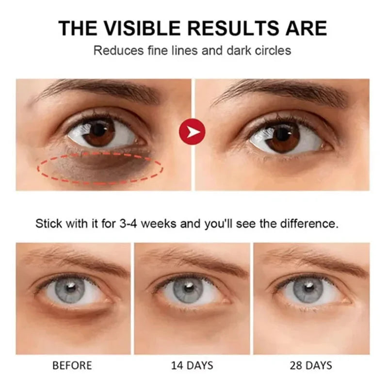 Instant Eye Bag Remove Eye Cream Anti Fat Particles Dark Circles Puffiness Fade Fine Lines Lift Brighten Korean Beauty Eye Care - AMULET RING STORE