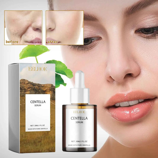 EELHOE Centella asiais essence moisturizing improve dry skin smooth tender skin brightening moisturizing essence