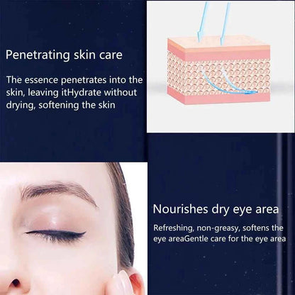 Double Care Essence Eye Set Eyes Repair Cream Eye Cream For Wrinkles Dark Circles Eye Bags Anti Age Firming Hydrating 3pcs