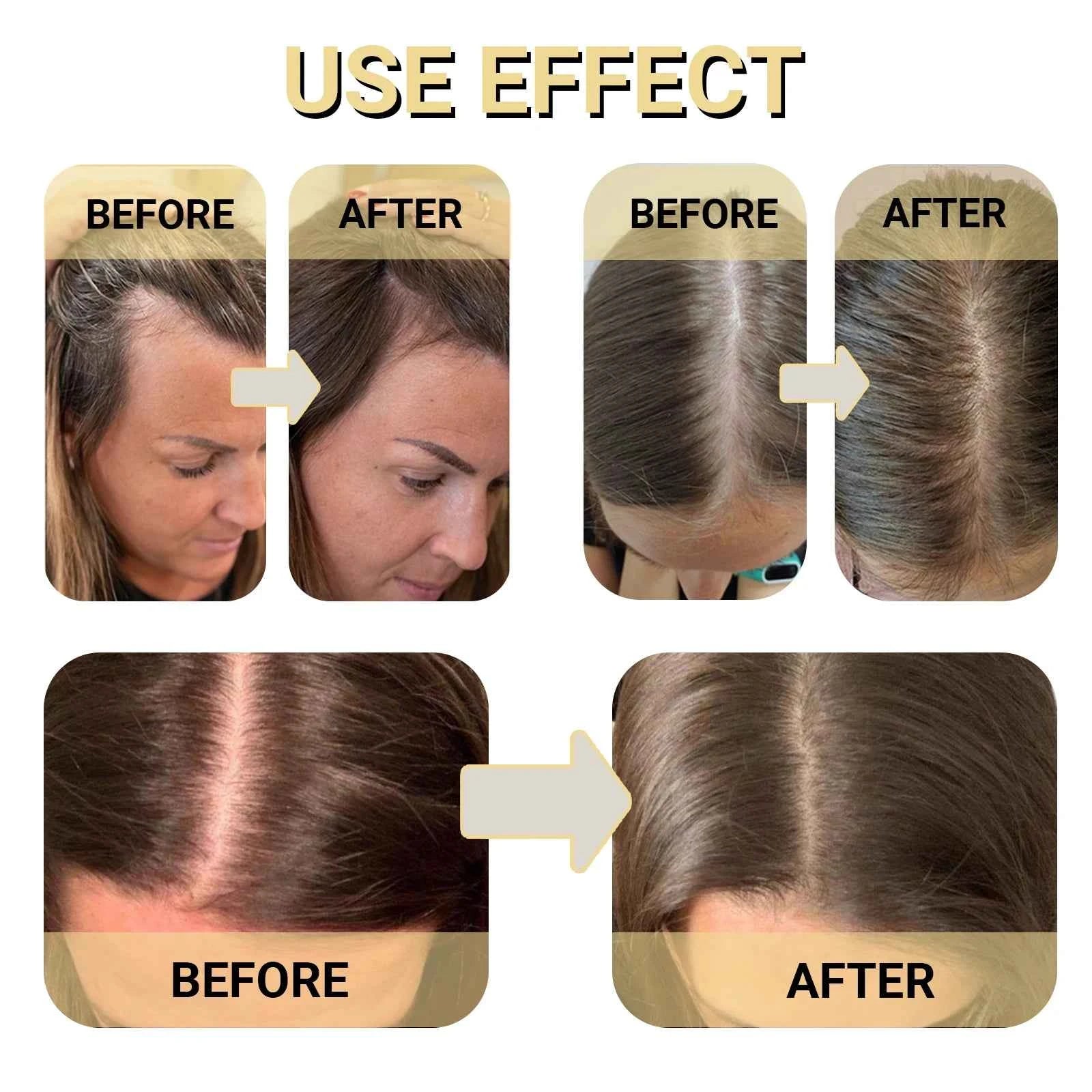 OUHOE Hair Boost Oil Dense Hair 2.11fl.oz (60ml) Makes Hair Thicker Healthier Promoting Hair Regeneration Caring Essential Oils