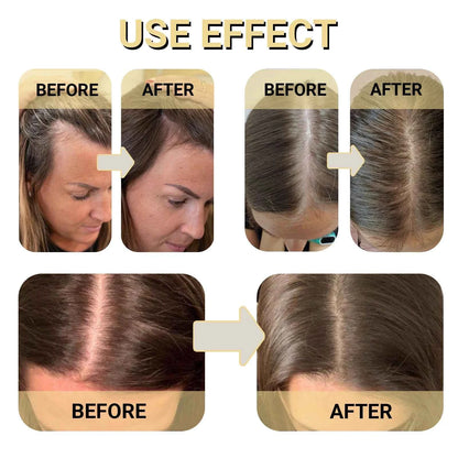 OUHOE Hair Boost Oil Dense Hair 2.11fl.oz (60ml) Makes Hair Thicker Healthier Promoting Hair Regeneration Caring Essential Oils