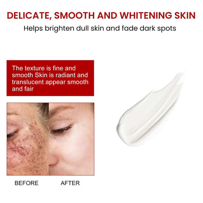 Ouhoe 20g Niacinamide Dark Spots Remover Cream Lighten Melanin Improve Dullness Brighten Skin Tone Smooth Face Repairing Cream