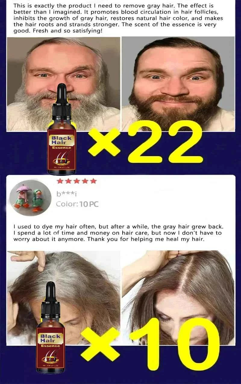 White hair killer, remove gray hair and restore natural hair color in 7 days 2025