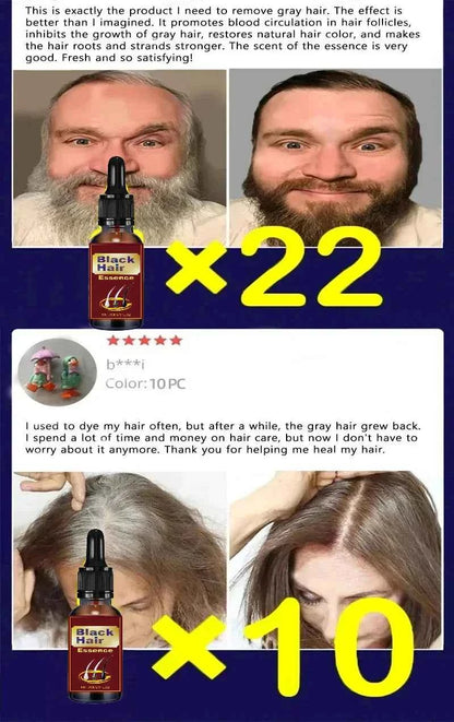 White hair killer, remove gray hair and restore natural hair color in 7 days 2025