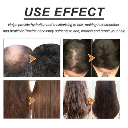 Fast Hair Growth Oil Rosemary Africa Crazy Traction Alopecia Serum Anti Hair Break Thicken Hair Loss Essential Oil For Man Women