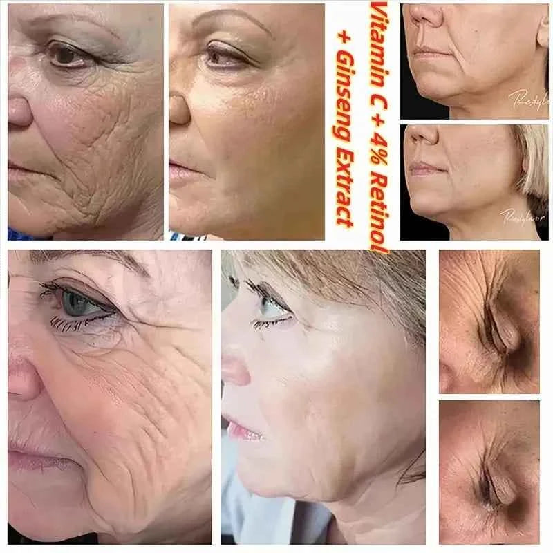 SEOUL 1988 Vitamin C Wrinkle Care 4% Retinol Ginseng Face Serum Firm Fine Lines Eye Cream Hydrating Moisturizing Brightening Set