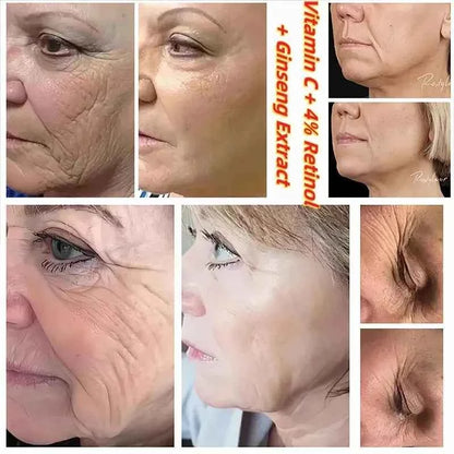 SEOUL 1988 Vitamin C Wrinkle Care 4% Retinol Ginseng Face Serum Firm Fine Lines Eye Cream Hydrating Moisturizing Brightening Set