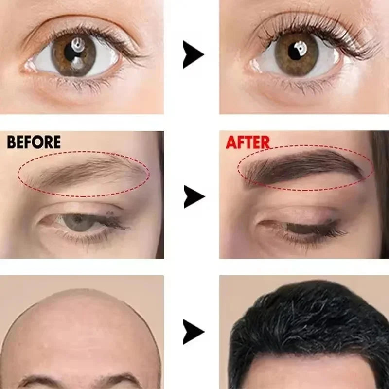 Fast Eyebrow Growth Serum Eyelash Hair Growth Anti Hairs Loss Product Prevent Baldness Fuller Thicker Lengthening Eyebrow Makeup - AMULET RING STORE