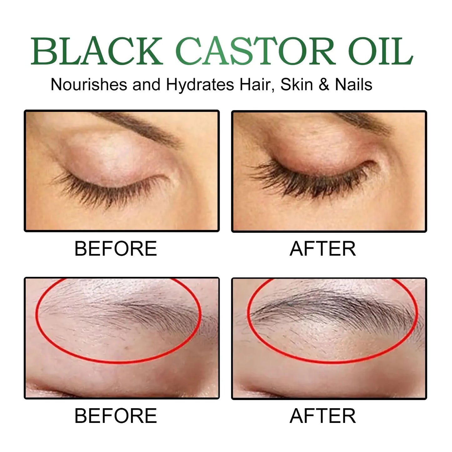 OUHOE Black Castor Oil 100% Organic Moisturize Hair Growth Serum Prevent Hair Loss Soft Bright Dense Hair Care Essential Oil