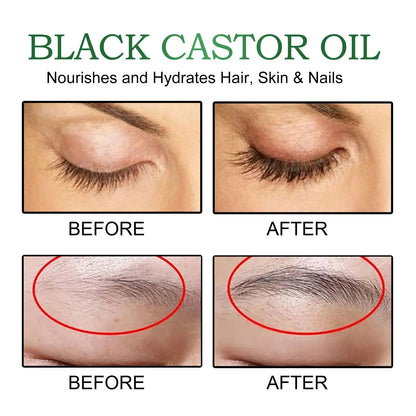 OUHOE Black Castor Oil 100% Organic Moisturize Hair Growth Serum Prevent Hair Loss Soft Bright Dense Hair Care Essential Oil