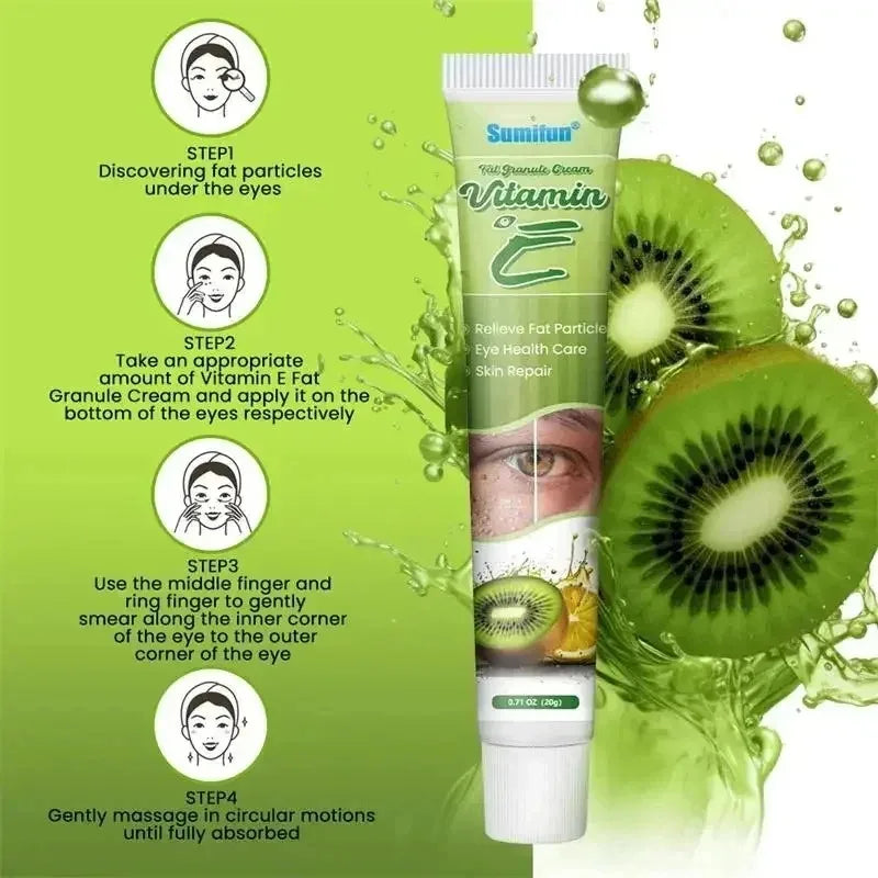 Fat Granules Remover Eye Cream Effective Remove Fat Granules Puffiness Anti-Particles Milia Remover Product Repair Eye Skin Care - AMULET RING STORE
