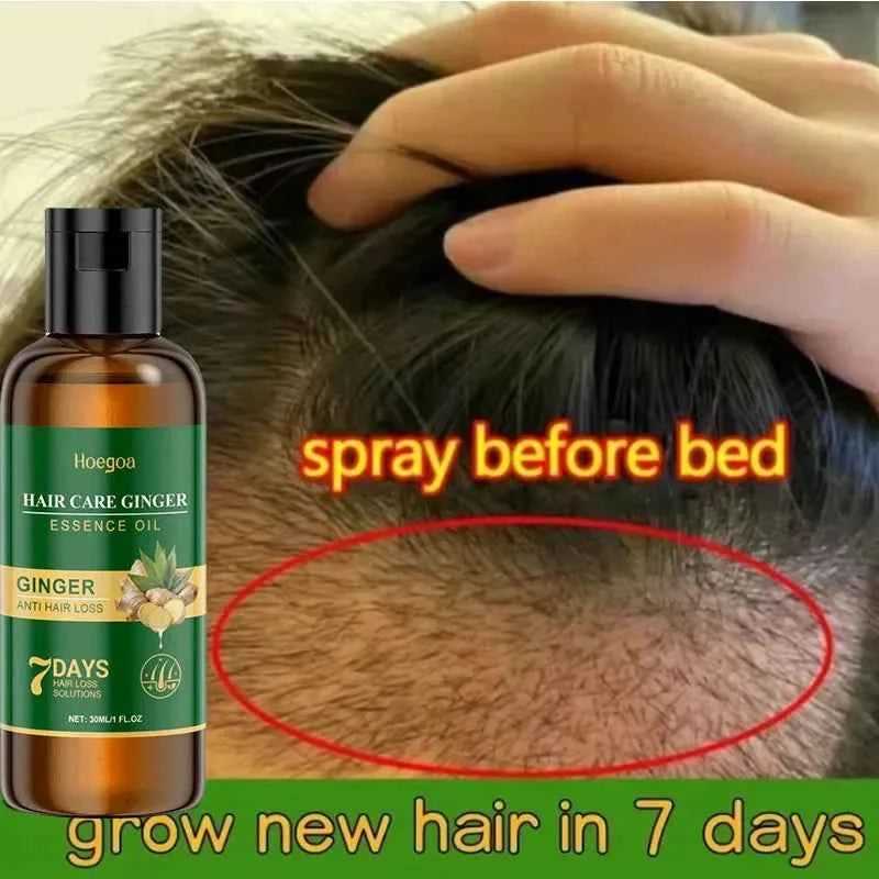 Ginger Hair Growth Serum 7 Days Fast Regrowth Essential Oil Anti Hair loss Prevent Hair Dry Frizzy Damaged Repair Care Products
