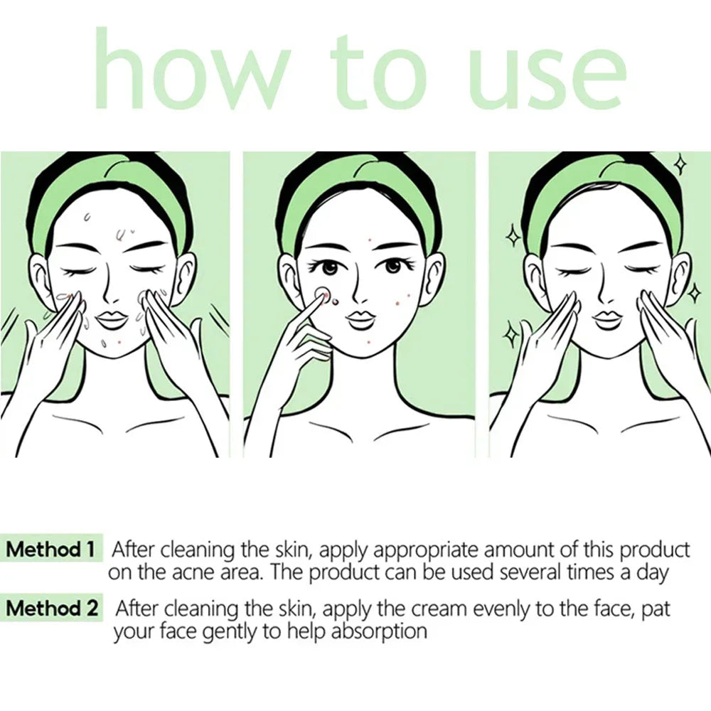 Pore Shrinking Cream Acne Pit Repair Products for Men and Women Remove acne mark scars Large pore anti-inflammatory smooth skin - AMULET RING STORE