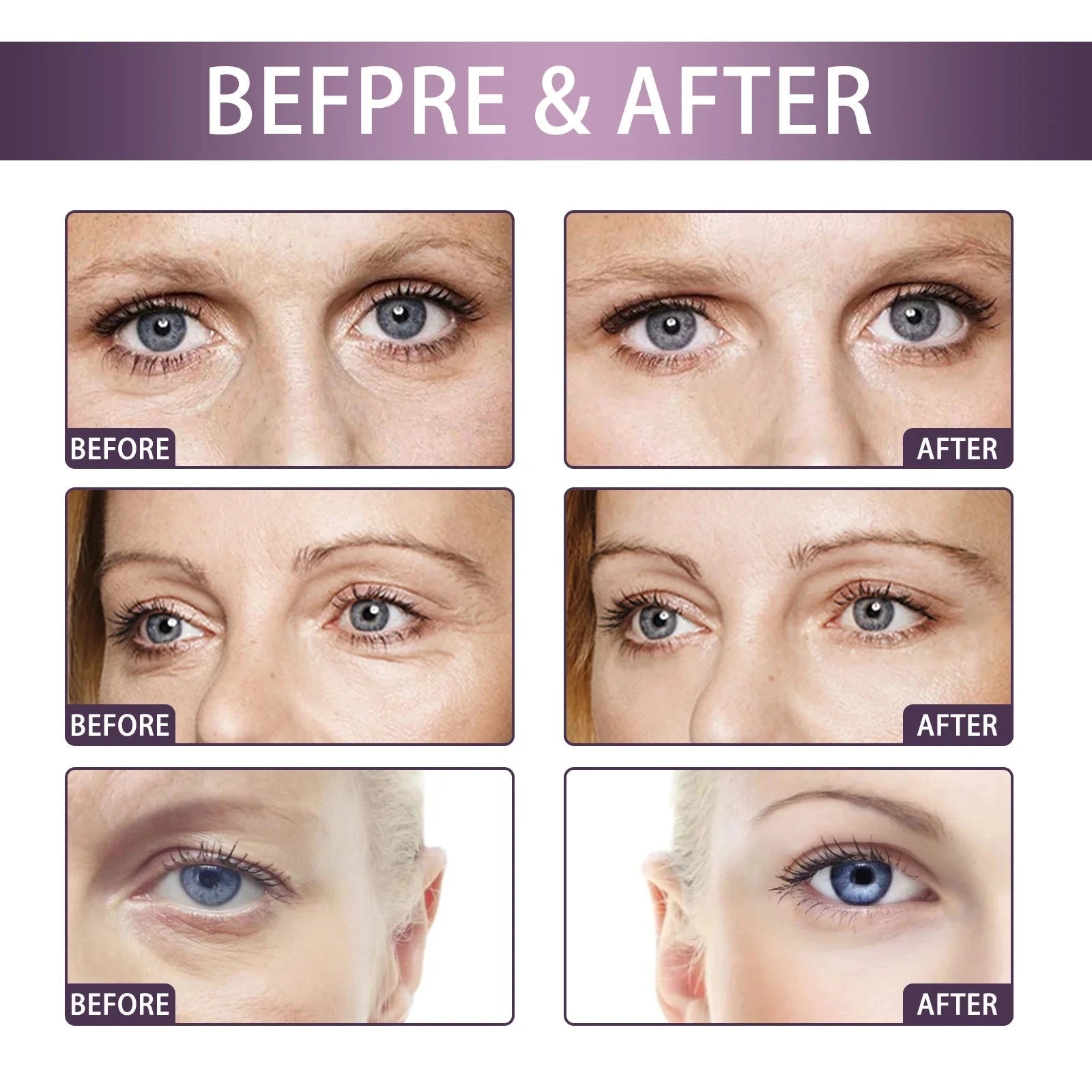 Electric Massage Eye Cream Anti Wrinkle Eye Patches Moisturizing Improve Bags Nourish Area Against Puffiness Bags Hydrate - AMULET RING STORE