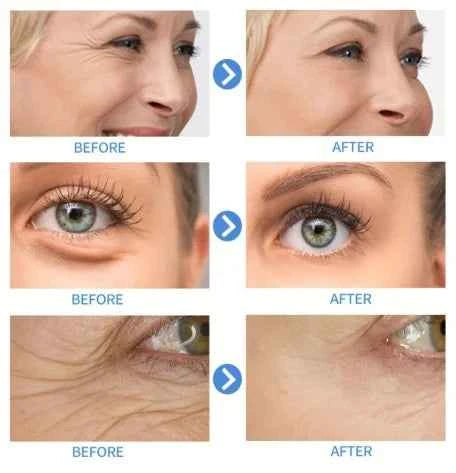 15ml Hyaluronic Acid Propylene Glycol Facial Essence Facial Lifting Collagen Essence Skin Care Whitening Essence Lightens Spots