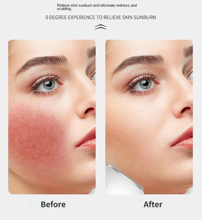 Face Skin Ice Roller Cooler Skin Lifting Face Cooling Massager Ice Compress Calm Skin Ice Cooler Eye Pouch Cooler Edema Remover