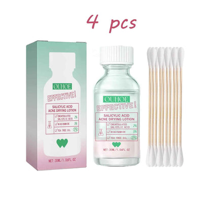 Ouhoe Salicylic Acid Acne Care Lotion Gentle Acne Treatment Pore Shrink Nourishing Improve Skin Texture Glowing Acne Care Lotion
